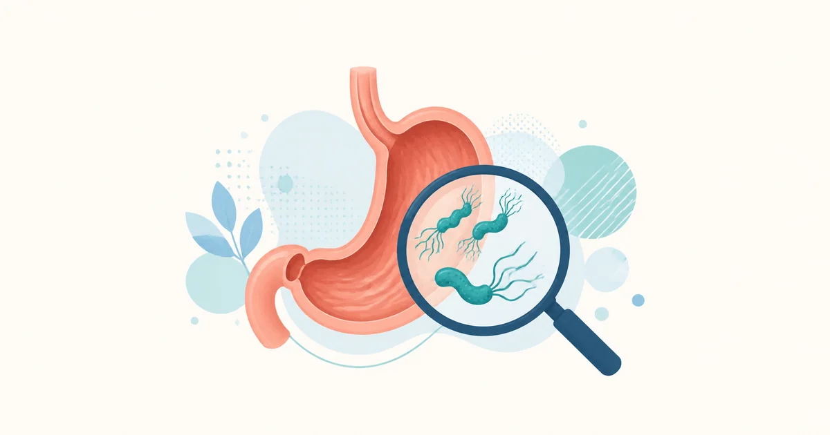Ilustracija želuca i spiralnih bakterija koja predstavlja infekciju Helicobacter pylori.